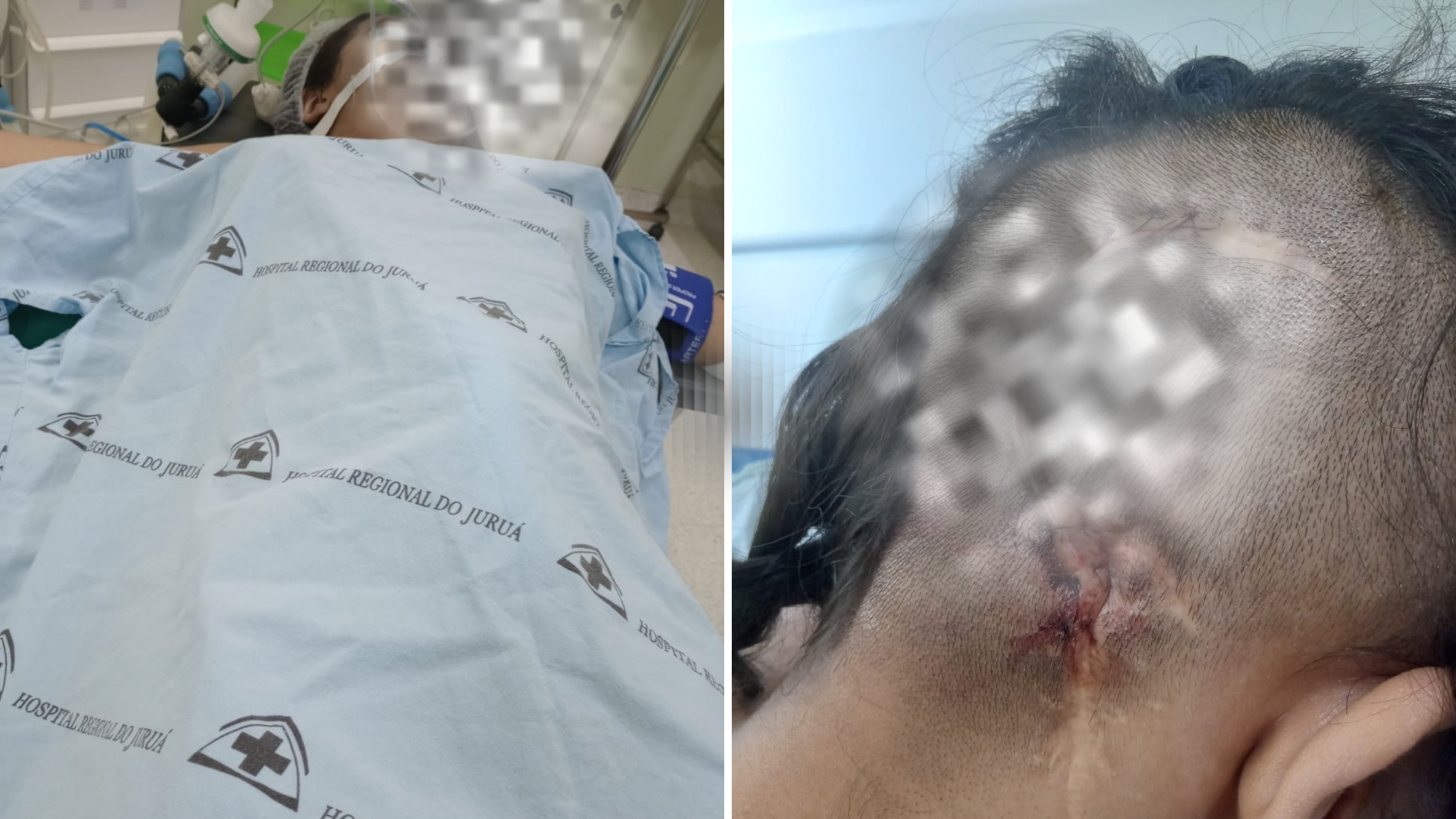 Mãe cobra resposta após 54 dias de espera por TFD em Cruzeiro do Sul