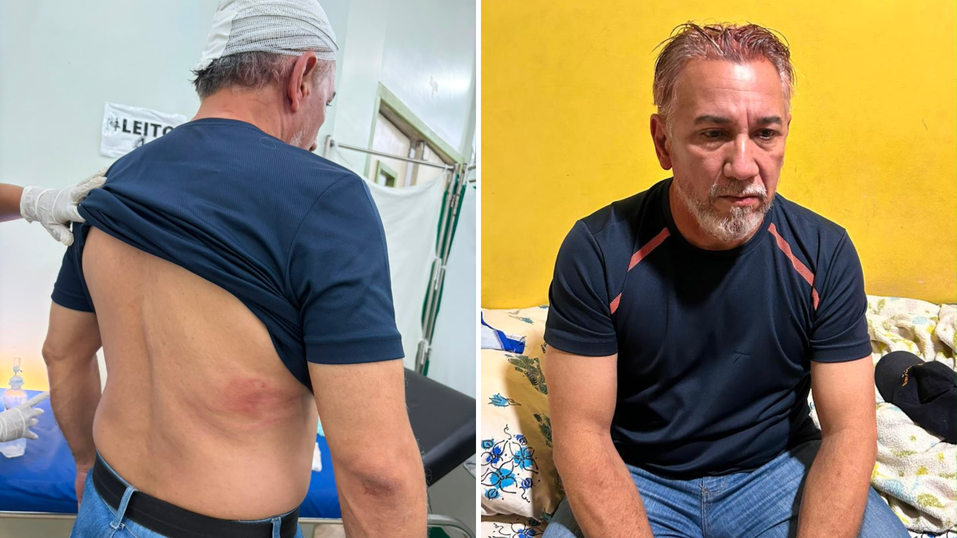 Autoridades cobram investigação e prestam solidariedade a Chico Melo após ataque em Cruzeiro do Sul